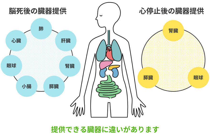 脳死後と心停止後の臓器提供の違い 日本臓器移植ネットワーク